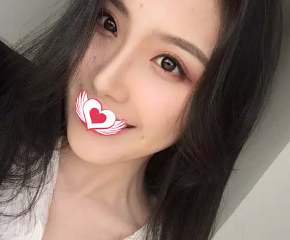 当你还在纠结要不要注射玻尿酸隆鼻时 我已经来唐山美联臣找白伟枫院长做硅胶隆鼻变翘鼻女神了 图2