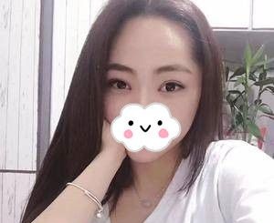 终于在湘潭雅美做了全切双眼皮,不到一个月恢复的这么好,我简直不敢相信 图2