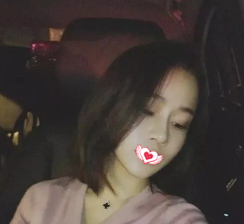 很庆幸自己找衡水天宏王慧东主任做鼻综合整形 术后只用22天就让我拥有精致小巧鼻 图2