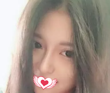 在秦皇岛念奴娇经历了硅胶隆鼻后才知道鼻子对整体面部轮廓影响会这么大 案例图2
