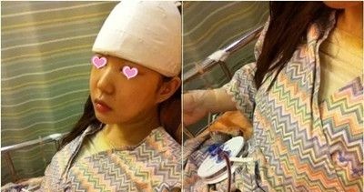 在上饶尚美整形做了假体隆胸手术后效果很好,下次打算找刘育风主任再做个自体脂肪丰苹果肌