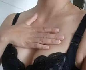 一个月前我找运城丽都整形王新灿做了自体脂肪隆胸来看消肿后的效果如何 图2