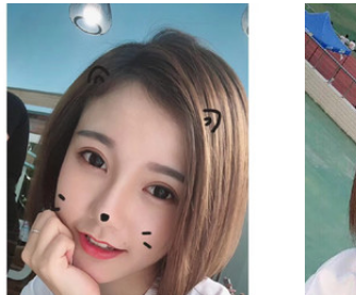 瞧我花1万多元找珠海新颜整形医院乐美芳医生做的全切双眼皮效果好看吗 图2