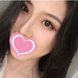 永州博美整形医院怎么样？看我找陈兵做的假体隆鼻术后三个月恢复效果！ 案例图2