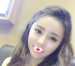 邯郸京美张伟做眼鼻综合整形效果很厉害 1个月时间让我的无神小眼和扁平塌鼻变成如今的媚眼翘鼻 图2