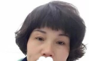 上眼皮松驰的我去郴州唯美咨询并直接做了切开双眼皮后老公说我年轻10岁! 图2