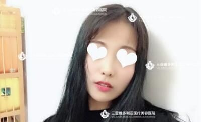 真人案例：分享我在三亚维多利亚整形医院做自体脂肪面部填充日记