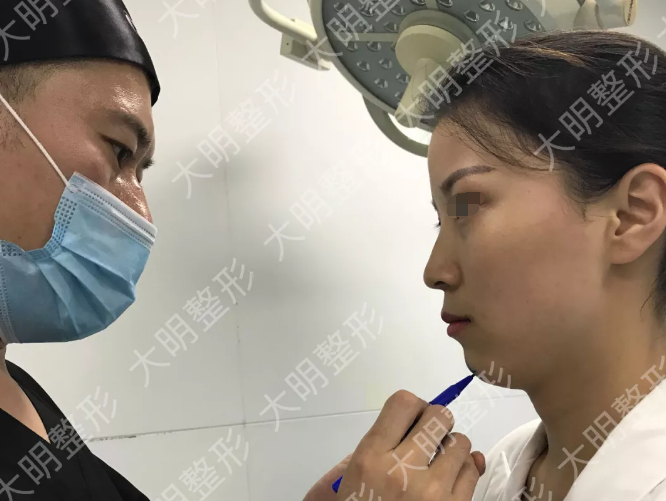 20分钟注射玻尿酸就改善了20多年的塌下巴 连云港大明员工亲证张培鉴院长微整效果