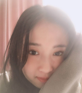 距离我在潍坊华美做全切双眼皮整形已经三个月了，分享我的恢复过程 案例图2