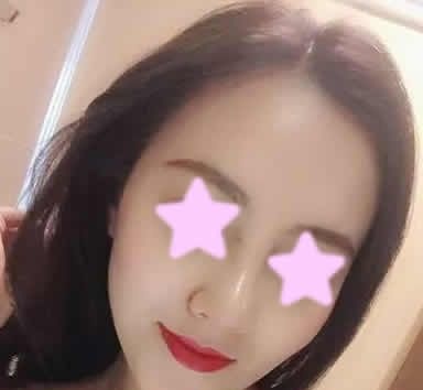仅仅是让聊城韩美整形倪景辉医生给我做了鼻综合,一个月后整个人都变洋气了 图2