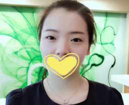 双眼皮贴贴久不会变双眼皮还会皮肤松弛 幸好我早早选择在廊坊华康做眼综合进行改善蜕变魅力电眼