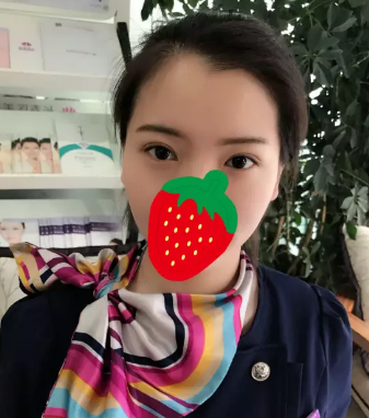 双眼皮贴贴久不会变双眼皮还会皮肤松弛 幸好我早早选择在廊坊华康做眼综合进行改善蜕变魅力电眼 图2