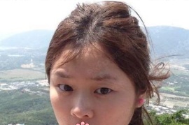 一年了，我把自己在新疆黎美整形许黎那儿做的6.5mm双眼皮术后恢复过程写了下来