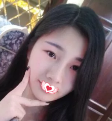 我想要的自然小翘鼻效果 终于找秦皇岛纪辉訾海涛医生做完鼻综合手术实现 图2