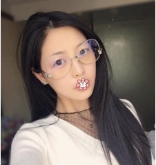 虽说去贵阳美莱整形钱刚那儿做面部吸脂恢复过程有点难熬,但效果我不得不服。 图2