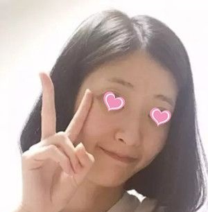 吉安天使整形医院做隆鼻手术怎么样?给大家分享下我手术一个月后的恢复效果