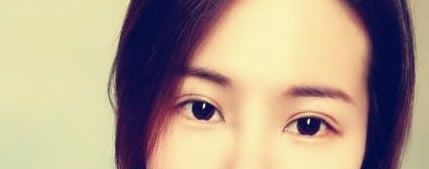 自从找金华玥莱美孙喜平做双眼皮手术效果恢复好后,朋友圈照片点赞的人超级多 图2