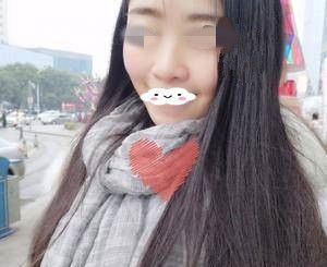 我在邵阳德美找李倩院长做了激光去红血丝,分享一下术后半个月的效果
