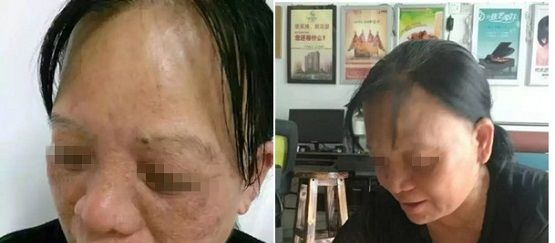 宜春祛斑哪家强?来围观这有两位深受斑点困扰的求美者的祛斑经历