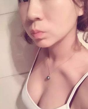 将我2个月前在秦皇岛巧致做假体隆胸手术的亲身体验分享给大家 图2