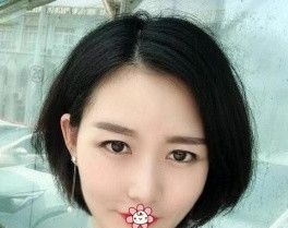 哦我把去贵阳华美整形美容医院面诊时要到的自体脂肪全脸填充价格和手术经历说给你听听。 图2