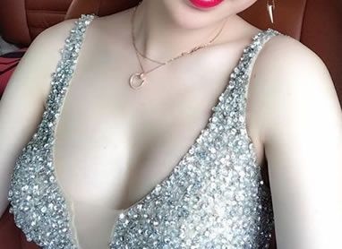 说做就做,到绍兴金柯桥整形医院花费近3万找冯利光做了曼托假体隆胸,过年可以美美哒 图2