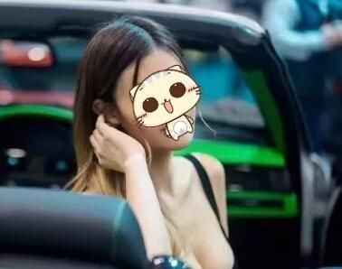 分享找扬州美贝尔做美国曼托水滴形假体隆胸案例,从腋窝下放入术后两月就完全恢复了 图2