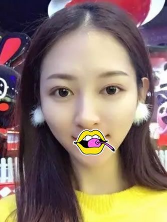 应付过年的各种party,有我找绍兴金柯桥谭成林院长做的双眼皮大眼睛足矣 图2