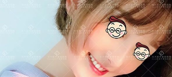 好嗨哟,2018年7月29日在永康光大整形做了鼻综合隆鼻和V脸术后感觉人生已经到达了巅峰 图2