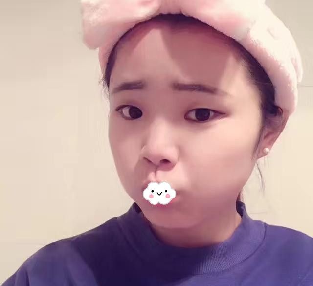 通过李军眼综合+隆鼻整形案例了解荆州华美割双眼皮做鼻子效果怎么样?