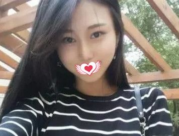 在秦皇岛巧致做完硅胶隆鼻术后1个月 终于拥有我梦寐以求的高挺俏丽自然鼻 图2