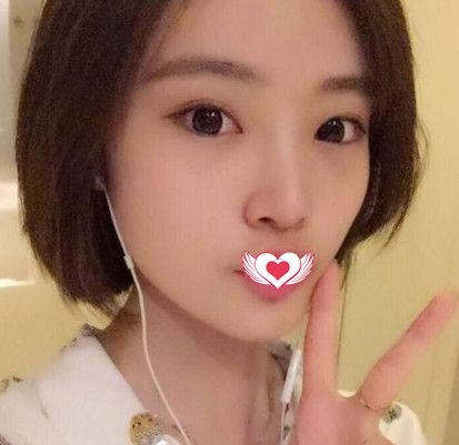 都说我找秦皇岛纪辉韦杰医生做硅胶隆鼻手术效果自然立体 你们觉得怎么样 图2