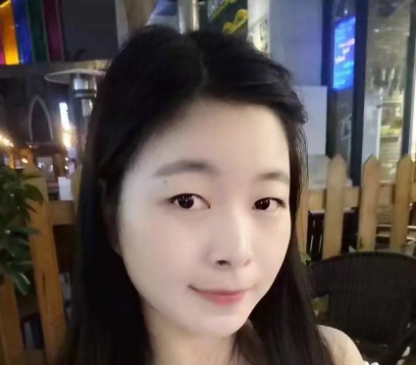 感觉自己单眼皮不好看于是去珠海仁爱找肖新春医生做了全切双眼皮手术
