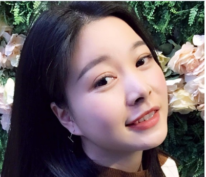 感觉自己单眼皮不好看于是去珠海仁爱找肖新春医生做了全切双眼皮手术 图2