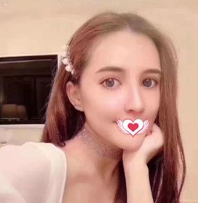 记录在邢台遇见美做鼻综合术后1个月的恢复情况 没想到我的矮塌鼻也能蜕变欧美范的高挺鼻 图2