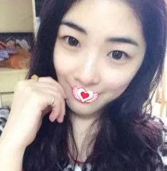 保定蓝山郑永生做自体耳软骨隆鼻术后1个月为我打造可以揉捏的人工美鼻