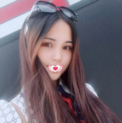 一起来看单眼皮+上睑下垂的我在邯郸丽人做完眼综合术后的效果怎么样 图2