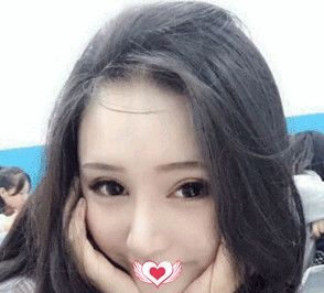 这次在邢台遇见美做的眼鼻综合手术 给我的感受就是整形前后对比效果反差挺大 案例图2