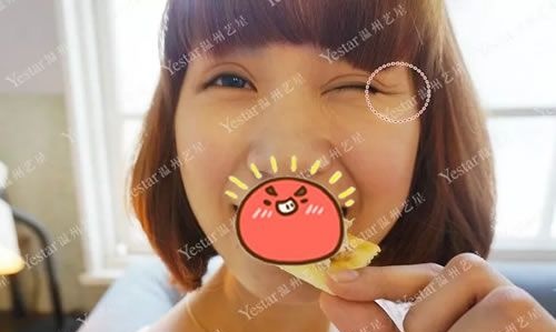 鱼尾纹如何消除,我选择温州Yestar艺星除皱针来去鱼尾纹,手术10分钟,8天后就挤不出皱纹了