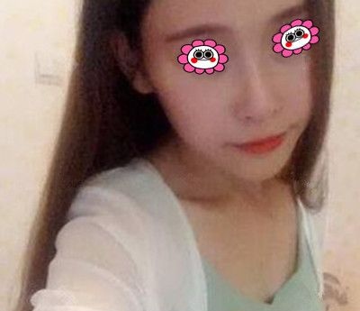 被调侃“飞机场”的我到株洲华美年华做了自体脂肪隆胸,手感和外观都很真实