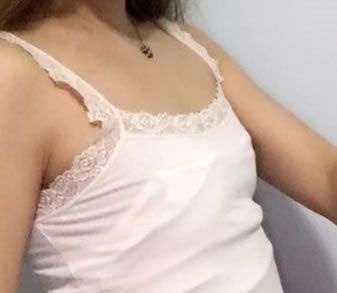 想要瘦腰丰胸一举两得,所以我去玉林时光整形做了自体脂肪隆胸