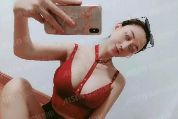 本身就不大的胸生宝宝哺乳后更平了还有些垂 老公带我到无锡爱思特做隆胸手术恢复自信的我 图2