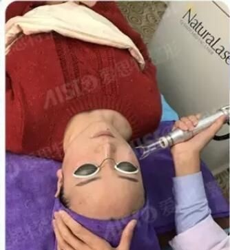 同事在无锡爱思特的祛斑效果打破我的疑虑,预约范红梅医生做了VISIA皮肤检测后体验大Q祛斑效果 图2
