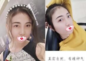 纹眉真人日记:我觉得我在锦州斯美诺整形美容医院做的这款雾眉真的好仙啊! 图2