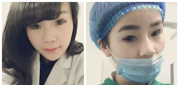 韩国进口玻尿酸伊婉好还是艾莉薇?在淮安华美得到答案后体验了1ml玻尿酸隆鼻效果还不错 图2