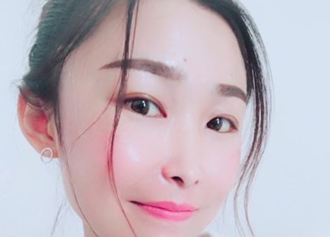 呼和浩特京美特邀医师刘文阁做M22激光祛斑多少钱?他给我做王者之冠三次就出效果了 图2