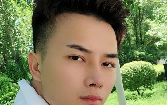 男生隆鼻要多少钱效果怎么样 包头华美白虎医生男生自体肋软骨隆鼻前后对比照片和价格可参考 图2