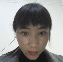 我皮肤不好,长痘痘,毛孔也大,直到去遵义韩美做了opt激光去雀斑变这样!