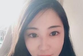 我在遵义韩美做这个取颊脂垫+面部吸脂手术是全麻的,感觉就是睡了个觉的工夫。 图2