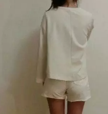 在威海做的大腿吸脂,65CM的腿围吸脂后瘦到57CM,我是一次就抽了3000CC 图2